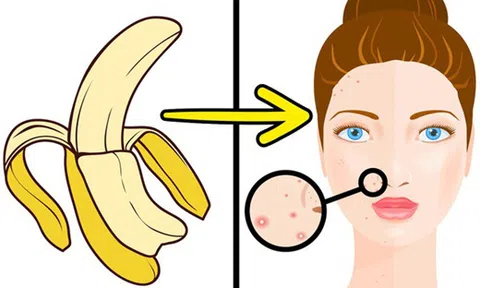 5 tác dụng của vỏ chuối khiến chị em phải mắt tròn mắt dẹt