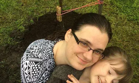 Bác sĩ da liễu nói gì về cách cấp cứu làn da bị cháy nắng gây sốt cộng đồng mạng?