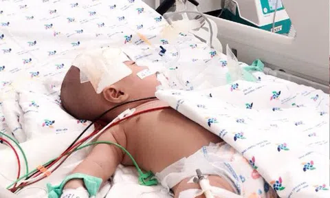 Tưởng con nhiễm siêu vi, không ngờ bị viêm màng não mủ