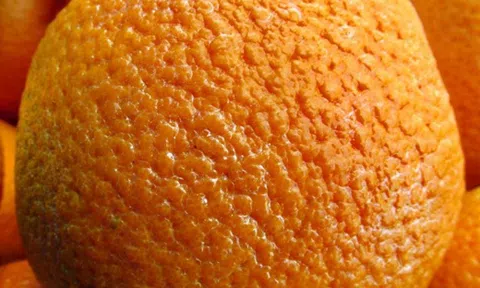 Chứng sần vỏ cam là gì và cách nào giải quyết để lấy lại làn da mịn màng?