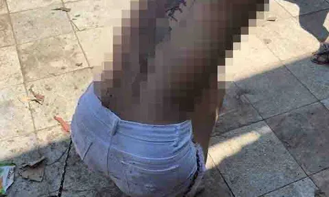 Cô gái nghi bị đánh ghen, đổ mắm tôm lên người ở Hà Nội