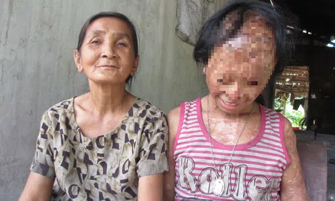 Bà nội cháu bé bị tạt axít muốn xin đôi mắt của tử tù Nguyễn Hữu Tình