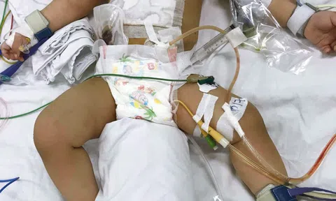 Vụ bé trai bị mẹ đâm thủng ruột: Người mẹ có phải chịu trách nhiệm hình sự?