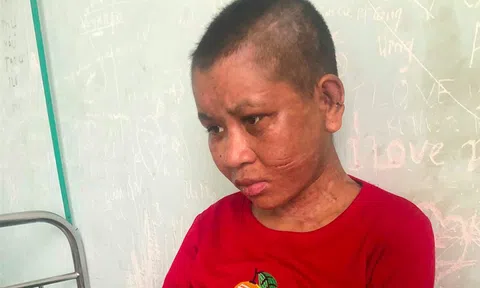 Lời kể của cô gái bị chủ đánh đập dã man ở Gia Lai