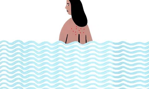 7 mẹo trị mụn lưng nhanh gọn giúp các nàng tự tin diện đồ hè