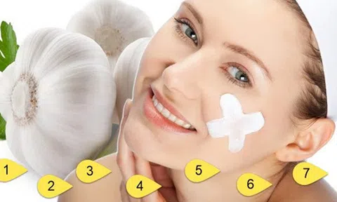 Bí quyết làm đẹp từ tỏi vừa đơn giản lại rẻ tiền bạn đã biết chưa?