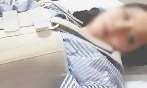 Sự thật cô gái Hà Nội vỡ đốt sống lưng sau một tiếng ho