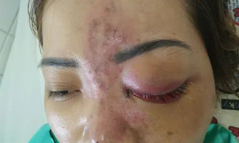 Đẹp ... quên chết