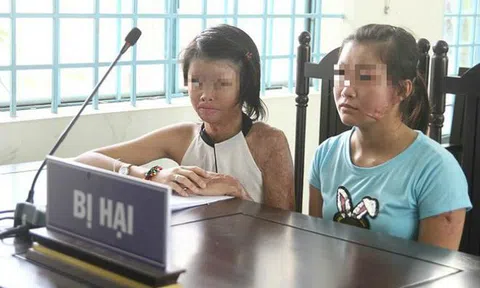 Khiếp đảm 1 cuộc chia tay bằng acid ở Cần Thơ