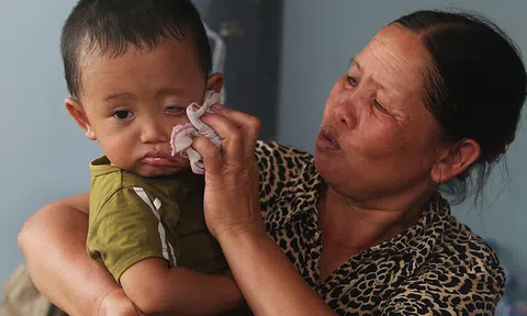 Người dân vùng ngập lụt Thủ đô Hà Nội mắc nhiều bệnh ngoài da