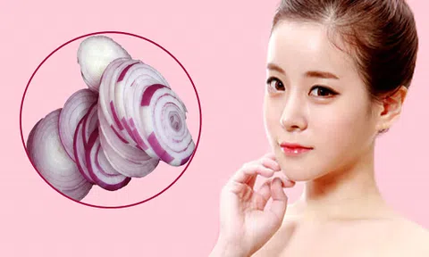 Làm đẹp da bằng hành tây ít ai biết đến nhưng công dụng khiến nhiều người bất ngờ