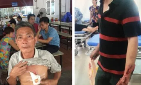 Đang ngồi nghỉ, 5 người trong một nhà bị nhóm đối tượng lạ tấn công nhập viện