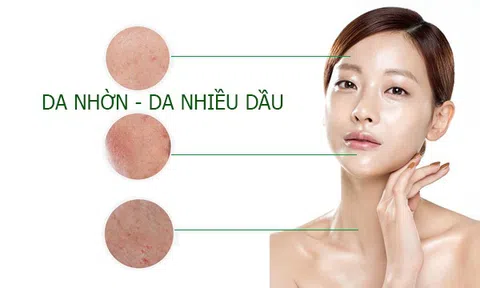 Công thức mặt nạ tự nhiên dành riêng cho da dầu
