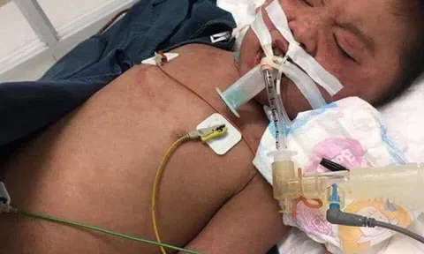 Hà Nội: Sau một đêm sốt cao, bé bị phát hiện nhiễm trùng máu, suy đa tạng