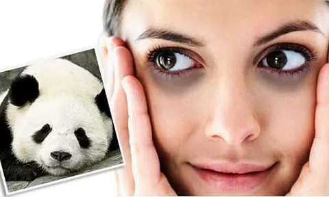 10 cách loại bỏ `mắt gấu trúc` trong nháy mắt