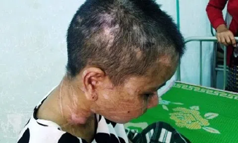 Truy tìm 5 người liên quan vụ hành hạ dã man người làm thuê ở Gia Lai