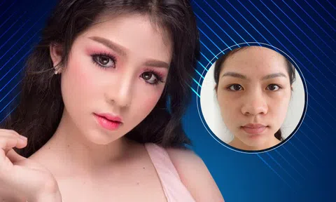 Những ca phẫu thuật mũi khó được “giải cứu” thành công