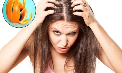 Bật mí cách trị gàu rẻ bèo mà hiệu quả chỉ với vỏ cam