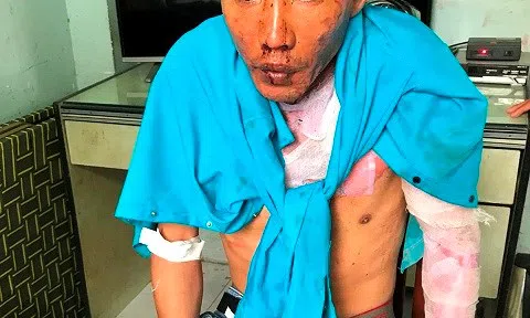 Chồng tẩm xăng thiêu vợ và 2 con gái vì bị đuổi ra khỏi nhà