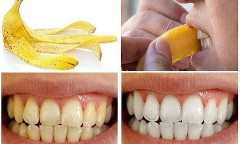 Sở hữu hàm răng trắng sáng bất ngờ nhờ vỏ chuối đơn giản nhưng hiệu quả