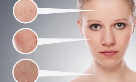 5 công thức mặt nạ tự nhiên giải nguy cho lỗ chân lông to mà bạn nên biết