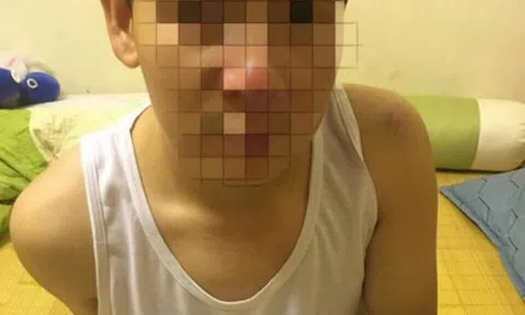 Bức xúc nhóm bảo vệ trường học hành hung nam thanh niên phải nhập viện