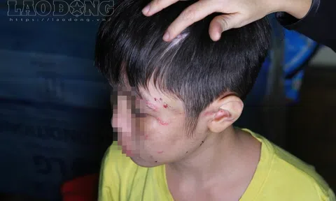 Ngày 31.8, xét xử vụ cha ruột mẹ kế bạo hành con trai 10 tuổi gây rúng động dư luận