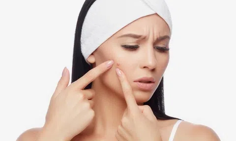 Nếu còn giữ những thói quen này thì dừng hỏi tại sao da nổi mụn thường xuyên