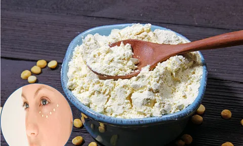 Giúp chị em thoát khỏi `cơn ác mộng` quầng thâm mắt chỉ nhờ bột đậu xanh 