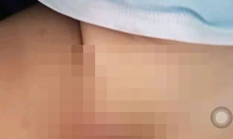 Nghi vấn cô giáo trường mầm non tư thục bạo hành khiến bé trai bị đứt vùng kín