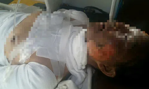 Người đàn ông ôm người tình rồi tẩm xăng tự thiêu