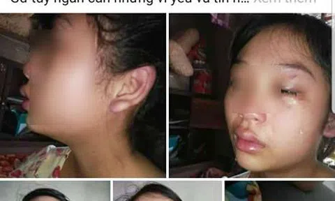 Vợ 16 tuổi lên mạng `tố` liên tục bị chồng bạo hành và đuổi khỏi nhà dù mới sinh con