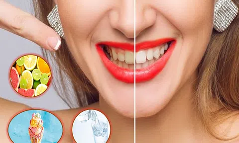 Điểm danh những thực phẩm tưởng vô hại nhưng lại khiến răng ố vàng nhanh chóng