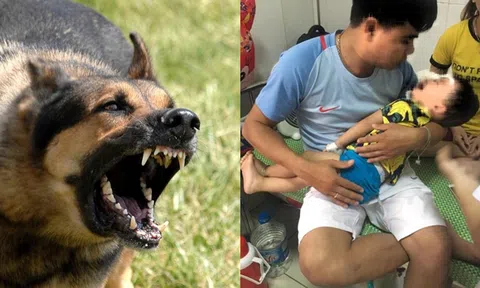 Nghệ An: Bé trai 2 tuổi bị chó Becgie nhà nuôi cắn nát mặt khi đang ăn bim bim