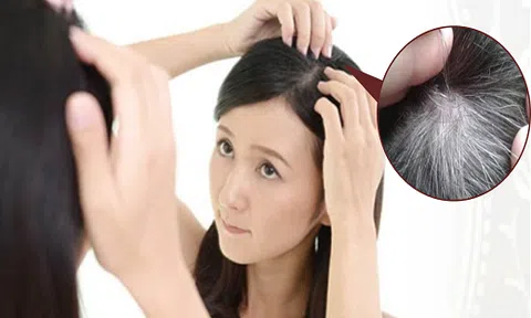 Mẹo nhỏ cho các chị em để ngăn ngừa tình trạng tóc bạc sớm