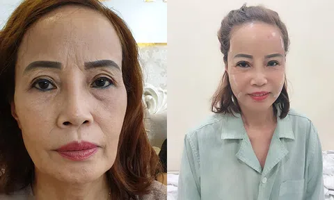 Chồng 26 tuổi mới cắt mí, vợ 62 ở Cao Bằng quyết tâm đi trùng tu để hóa thiên nga