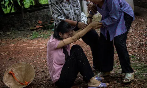 Con dâu bị đánh, mẹ chồng không bênh còn đổ thêm dầu vào lửa 