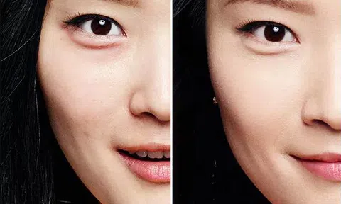 Đánh bay quầng thâm mắt sau 5 ngày nhờ hỗn hợp sữa chua này