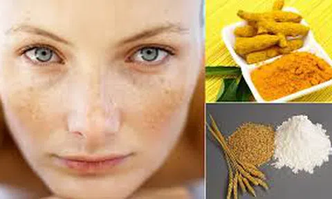 Cách chữa tàn nhang tại nhà hiệu quả nhất