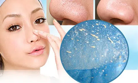 Hướng dẫn bạn 3 cách trị mụn đầu đen bằng tinh bột nghệ hiệu quả ngay tại nhà