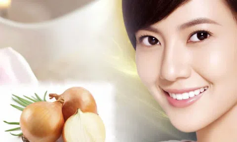 Chỉ 1 củ hành tây đánh bay nám, tàn nhang chẳng tốn tiền, chẳng tốn công