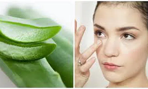 Cách điều trị da không đều màu chỉ bằng 1 nhánh lô hội, hiệu quả ngay sau 1 tuần