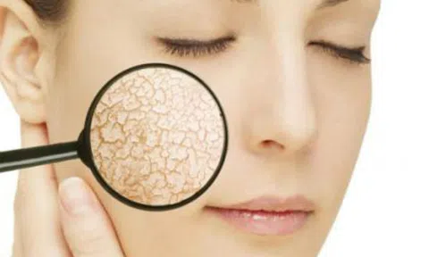 Bật mí 2 cách đắp mặt nạ cho da khô trắng hồng mịn màng