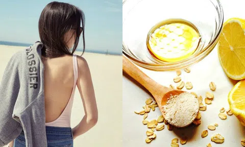 Bật mí cách trị mụn ở lưng tại nhà rất hiệu quả