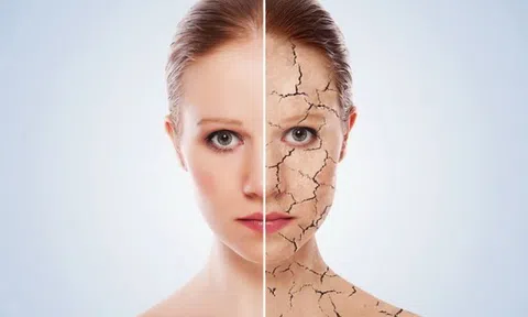 Mùa đông da khô `mốc` phải làm thế nào?