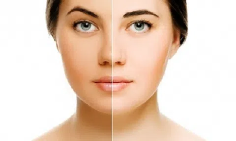 Học ngay 3 cách trị da mặt không đều màu sau một thời gian da sáng mịn trông thấy