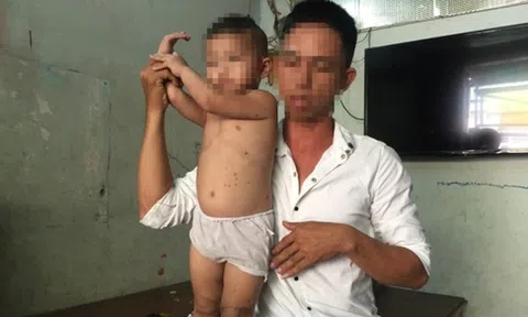 Nghi án đặt thuốc nổ trong micro, 2 mẹ con bị thương