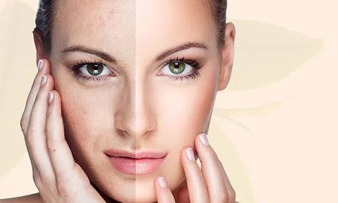 5 điều lầm tưởng về chăm sóc da có thể các nàng chưa biết