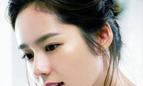 Chỉ 1 nhánh tỏi `đánh bay` mụn ruồi trên mặt