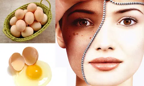 Học ngay 3 cách dưỡng trắng da bằng trứng gà